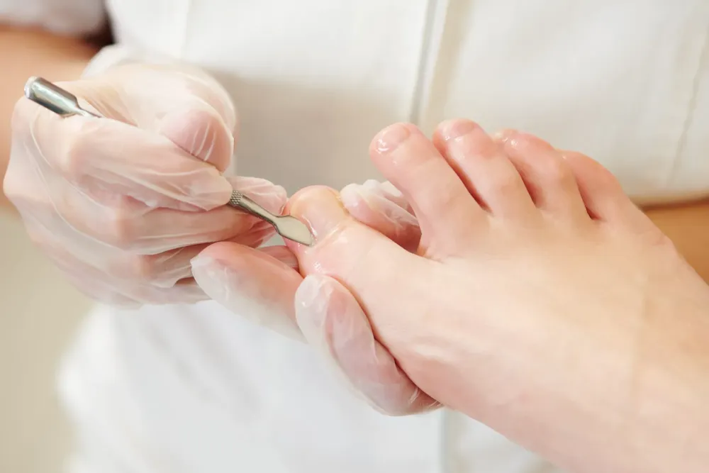 soins des ongles à  Marseille