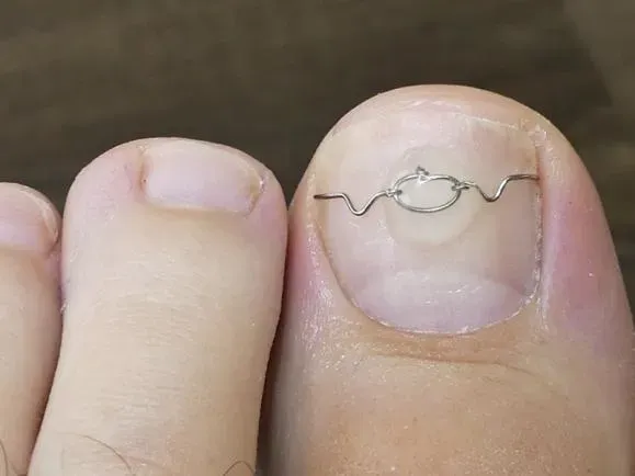 soins des pieds à  Marseille