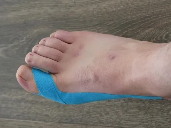 Orthoplastie
